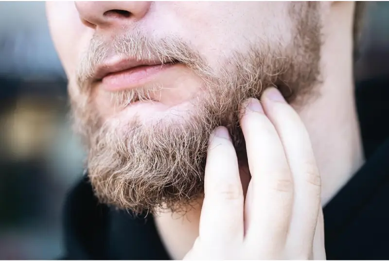 beard transplant in istanbul
